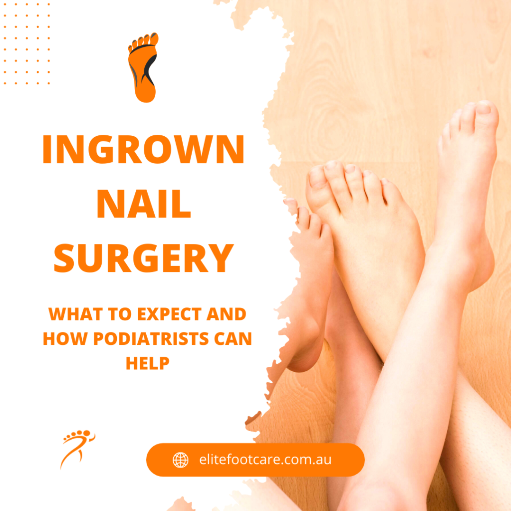 Ingrown Toenail Surgery Sunshine Coast