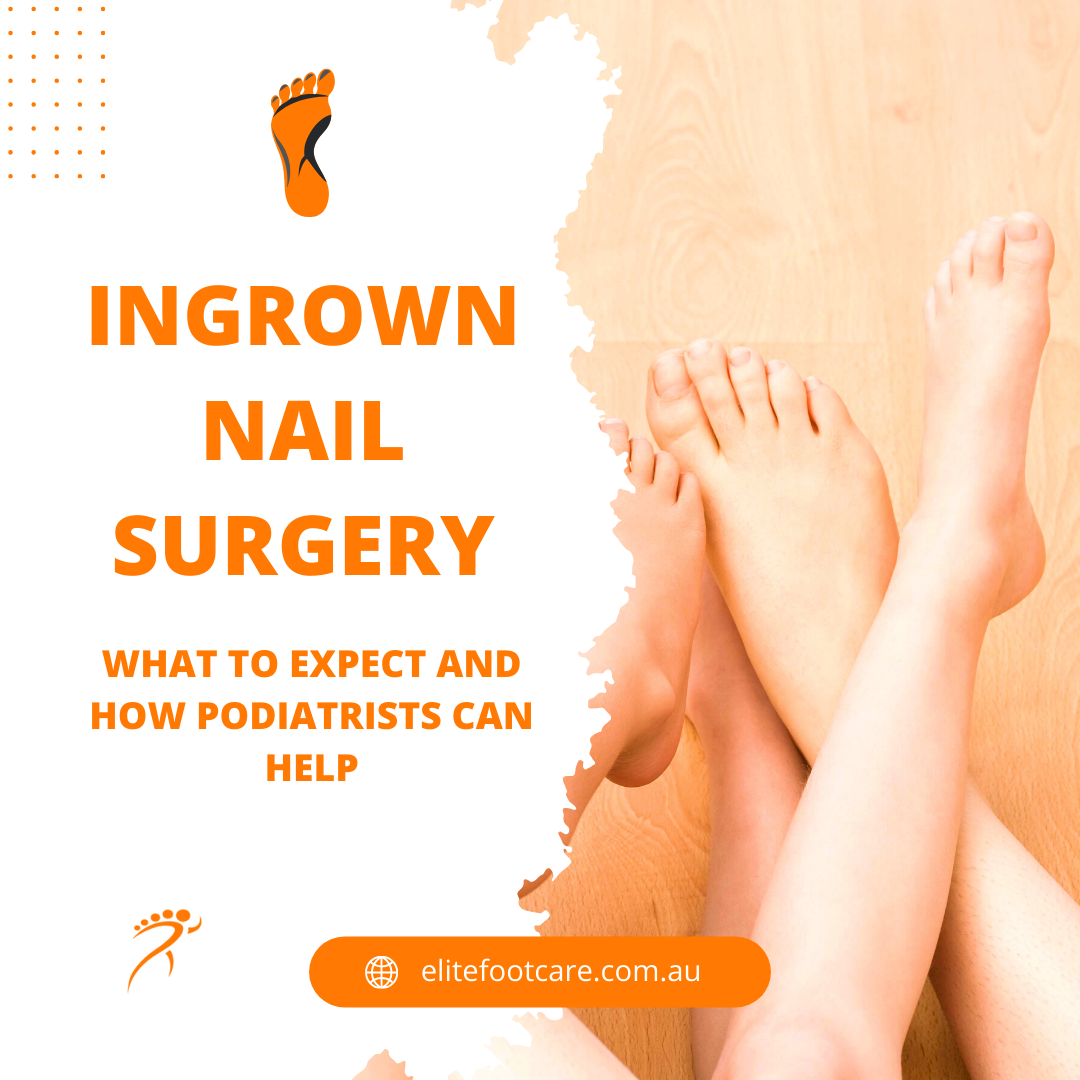 Nail Surgery | Newcastle, Hexham, Gosforth | Newcastle Foot Clinic