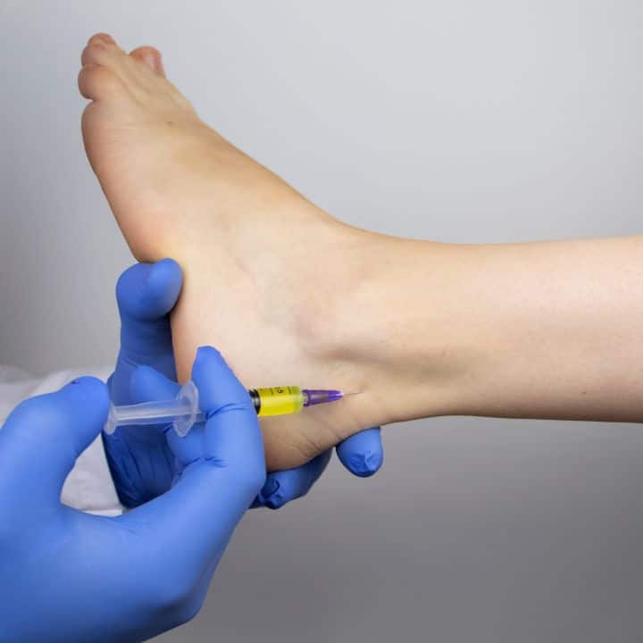 Prolotherapy Injection - Elite Foot Care