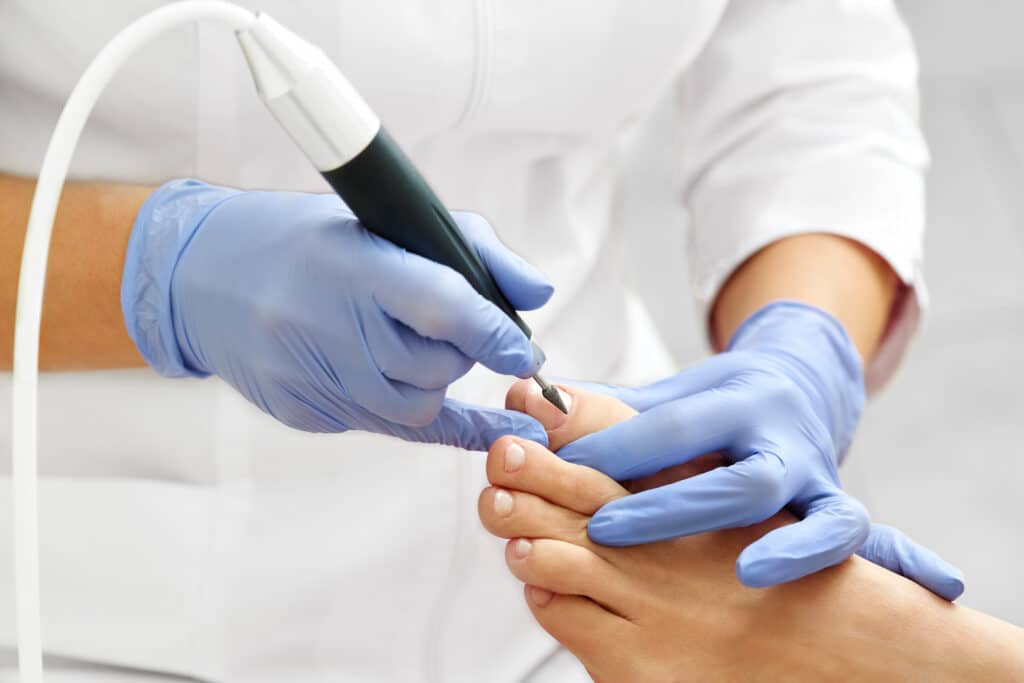 General Skin and Nail Treatment - Sunshine Coast Podiatrists