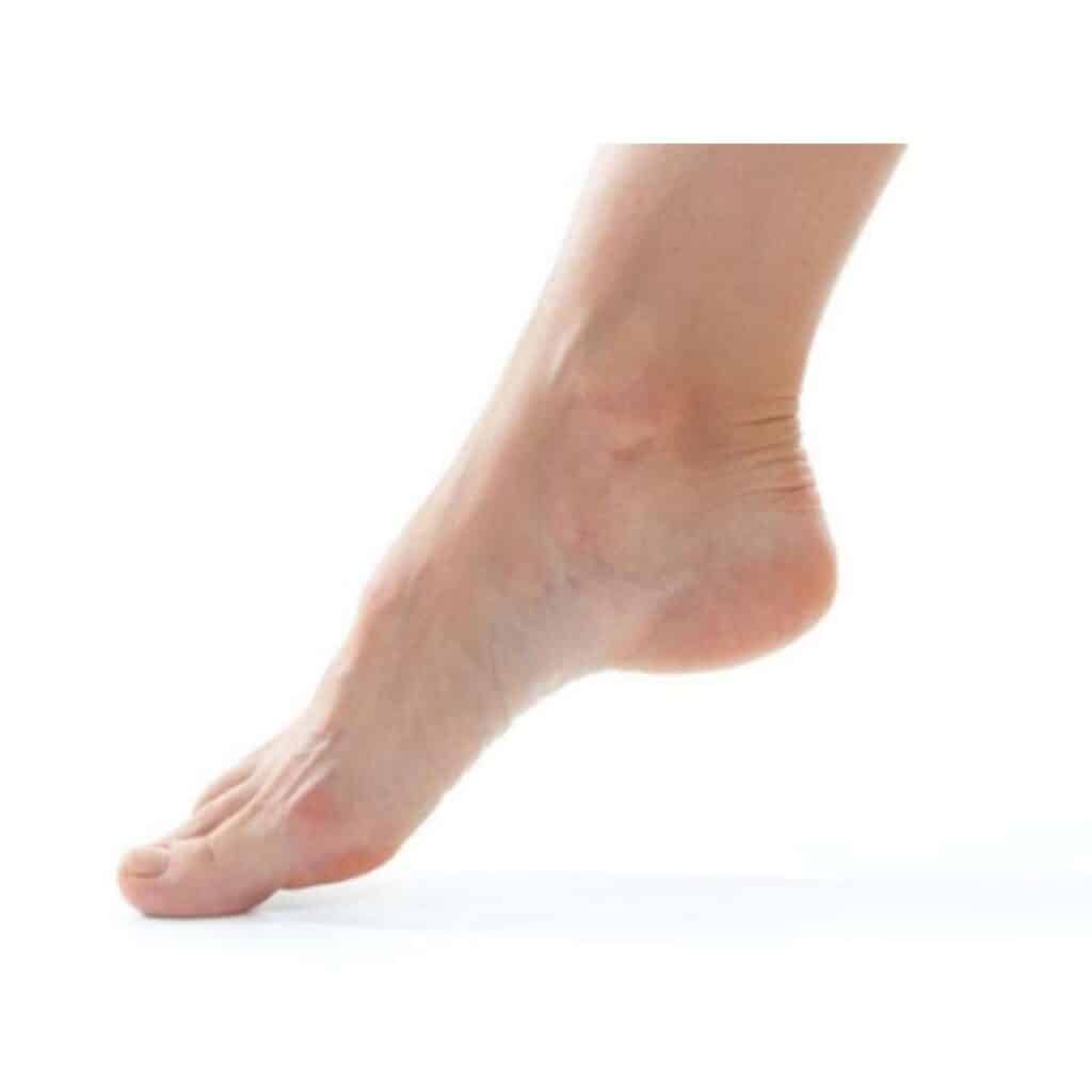 Foot Drop - Elite Foot Care Sunshine Coast Podiatrists