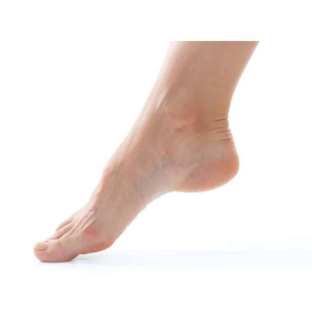 Foot Drop - Symptoms, Causes & Treatment